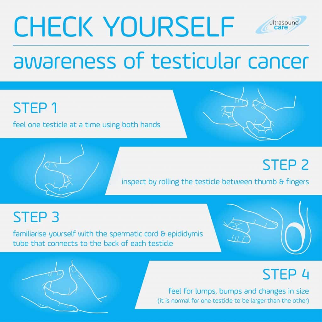 Testicular cancer infographic