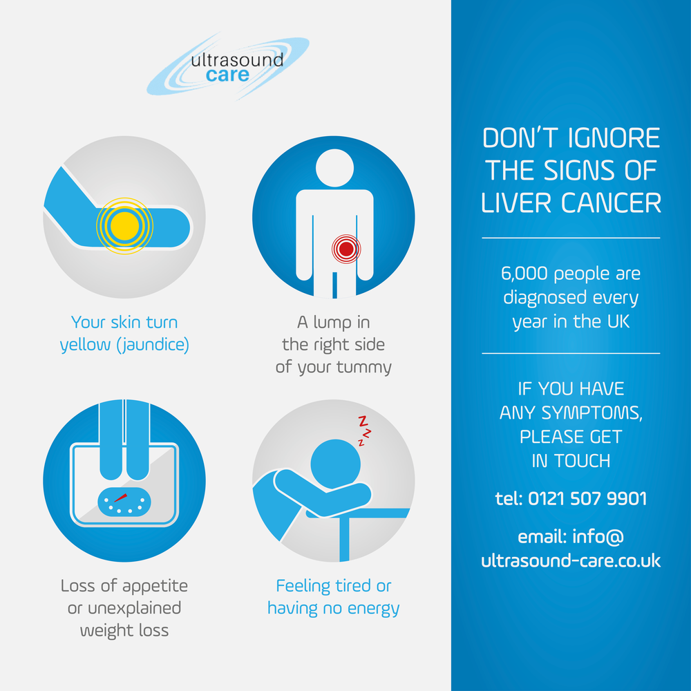 Liver Cancer Birmingham