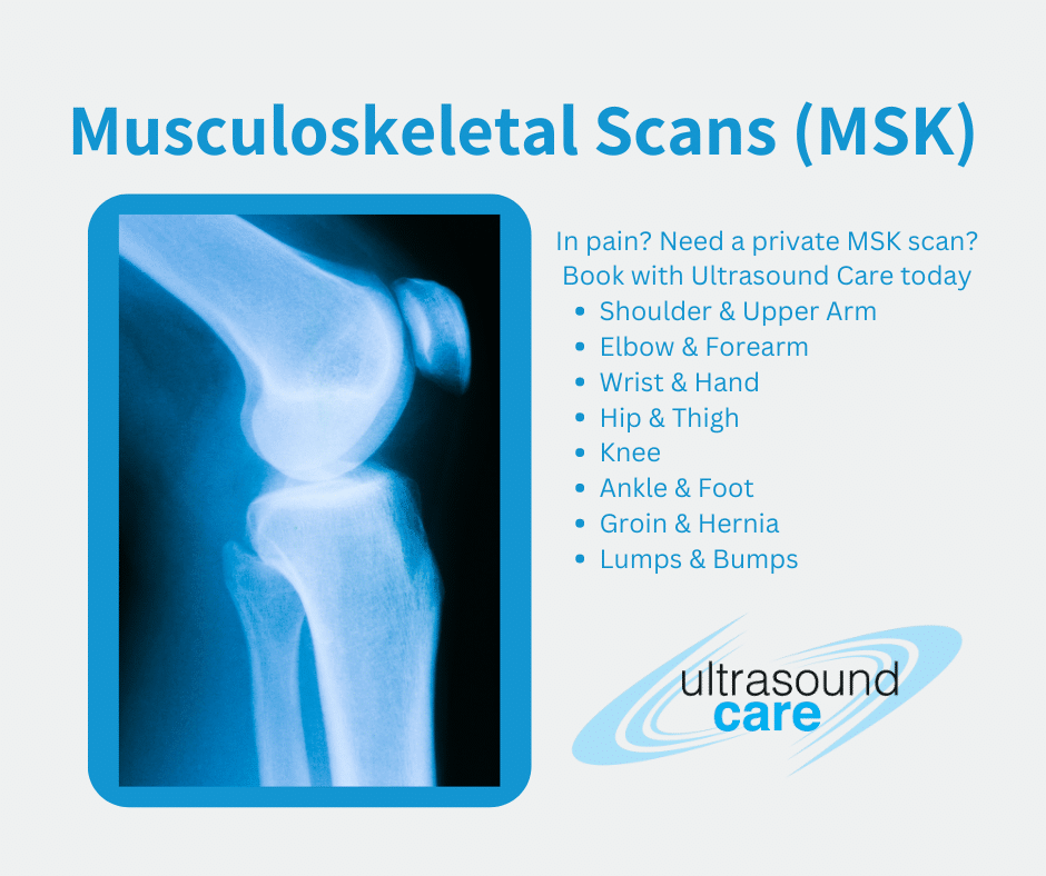 MSK Scans blog - x-ray of shoulder with MSK scans listed