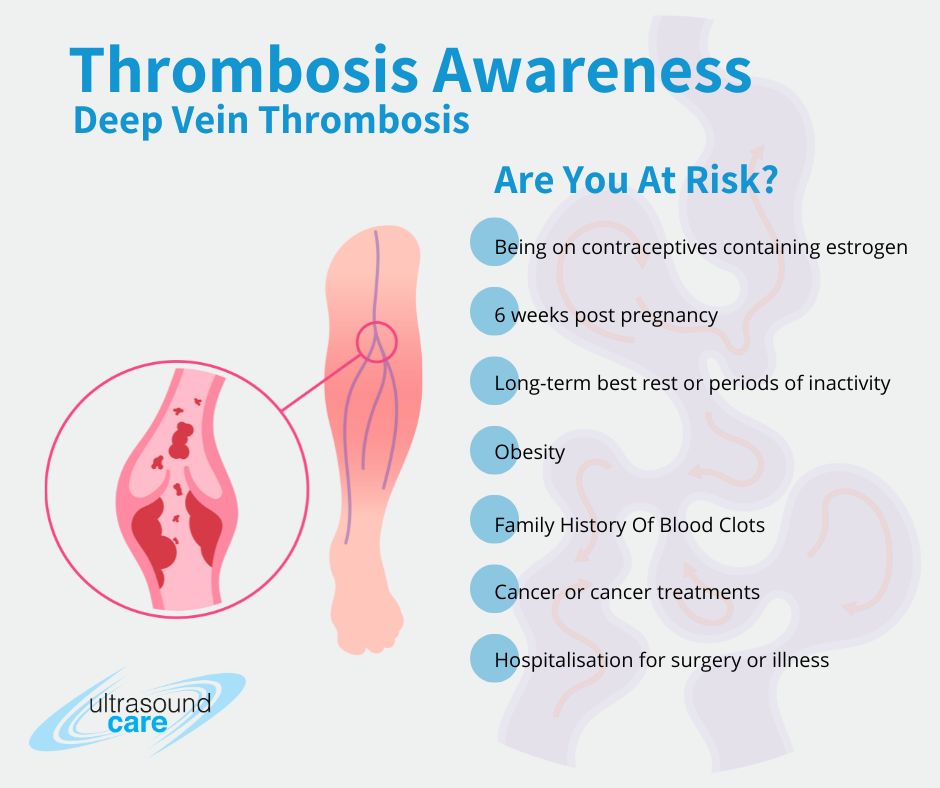 DVT Awareness featured image