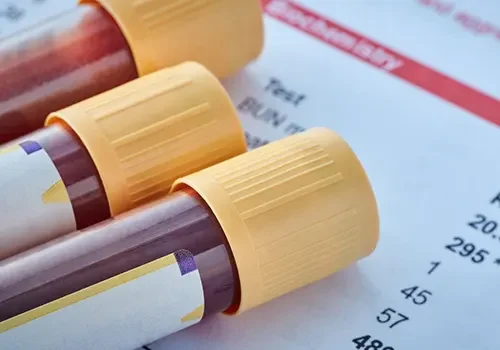 Blood-Tests-landscape-4ec8875c3dd1cac062f1fa0597e89a33-f61dbvpemi25